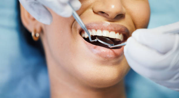 Best Emergency Dental Care for Sports Injuries in Dollar Bay, MI